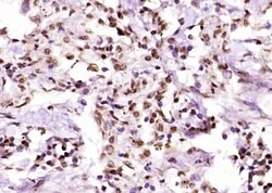 AMPK beta 1 Rabbit anti-Human, Polyclonal, Bioss 100 &mu;L; Unconjugated:Antibodies,