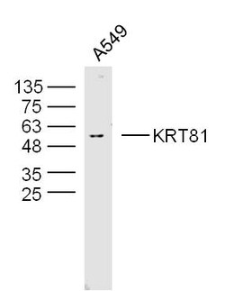 KRT81 Rabbit anti-Human, Polyclonal, Bioss 100 &mu;L; Unconjugated:Antibodies,