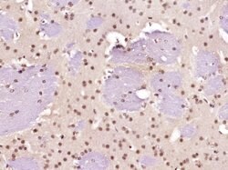 Neurogenic locus notch homolog protein 1 Rabbit anti-Human, Polyclonal,
