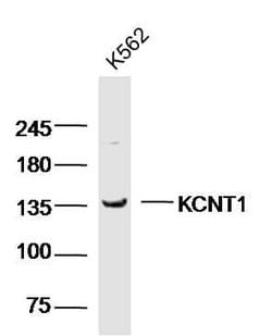 KCNT1 Rabbit anti-Human, Polyclonal, Bioss 100 &mu;L | Buy Online | Bioss | Fisher Scientific