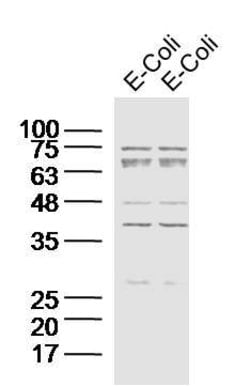 E.coli DH-5 Alpha Rabbit anti-Human, Polyclonal, Bioss 100 &mu;L; Unconjugated:Antibodies,