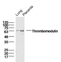 Thrombomodulin Rabbit anti-Human, Polyclonal, Bioss 100 &mu;L; Unconjugated:Antibodies,