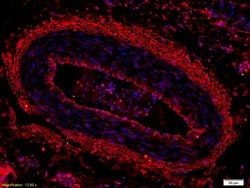 CK18 Rabbit anti-Human, Polyclonal, Bioss 100 &mu;L; Unconjugated:Antibodies,