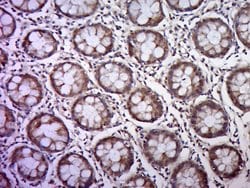 CK18 Rabbit anti-Human, Polyclonal, Bioss 100 &mu;L; Unconjugated:Antibodies,
