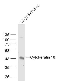 CK18 Rabbit anti-Human, Polyclonal, Bioss 100 &mu;L; Unconjugated:Antibodies,
