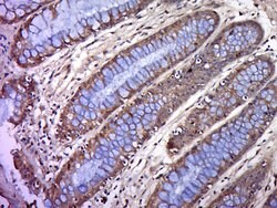 BTN2A1 Rabbit anti-Human, Polyclonal, Bioss 100 &mu;L | Buy Online | Bioss | Fisher Scientific