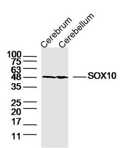 SOX10 Rabbit anti-Human, Polyclonal, Bioss 100 &mu;L; Unconjugated:Antibodies,