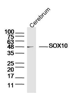 SOX10 Rabbit anti-Human, Polyclonal, Bioss 100 &mu;L; Unconjugated:Antibodies,