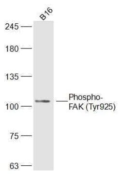 Phospho-FAK (Tyr925) Rabbit anti-Human, Polyclonal, Bioss 100 &mu;L | Buy Online | Bioss | Fisher Scientific