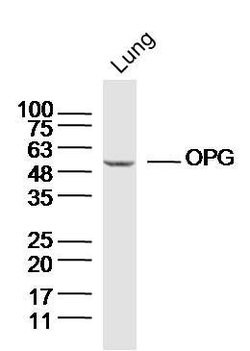 OPG Rabbit anti-Human, Polyclonal, Bioss 100 &mu;L; Unconjugated:Antibodies,