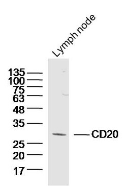 CD20 Rabbit anti-Human, Polyclonal, Bioss 100 &mu;L; Unconjugated:Antibodies,