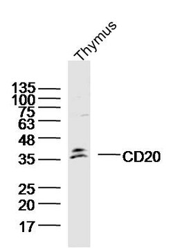 CD20 Rabbit anti-Human, Polyclonal, Bioss 100 &mu;L; Unconjugated:Antibodies,