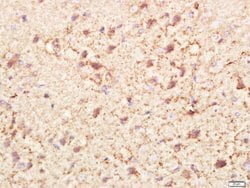 PI3KCA Rabbit anti-Human, Polyclonal, Bioss 100 &mu;L | Buy Online | Bioss | Fisher Scientific