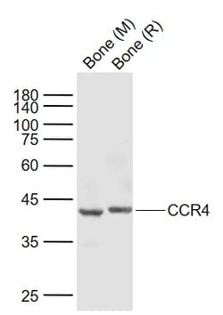 CCR4 Polyclonal Antibody, Bioss 100 &mu;L | Buy Online | Bioss | Fisher Scientific