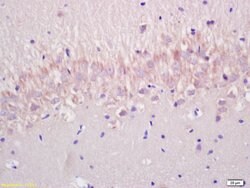 P53wt-p53 Rabbit anti-Human, Polyclonal, Bioss 100 &mu;L; Unconjugated:Antibodies,