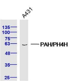 PAH/PH4H Rabbit anti-Human, Polyclonal, Bioss 100 &mu;L; Unconjugated:Antibodies,
