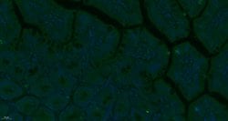 TEM1/CD248 Rabbit anti-Human, Polyclonal, Bioss 100 &mu;L; Unconjugated:Antibodies,
