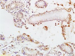 TEM1/CD248 Rabbit anti-Human, Polyclonal, Bioss 100 &mu;L; Unconjugated:Antibodies,