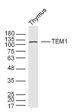 TEM1/CD248 Rabbit anti-Human, Polyclonal, Bioss 100 &mu;L; Unconjugated:Antibodies,