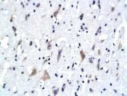 5-HTR3/HTR3A Rabbit anti-Human, Polyclonal, Bioss 100 &mu;L; Unconjugated:Antibodies,