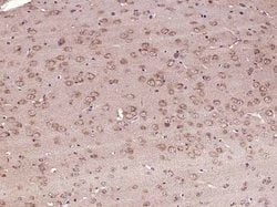 5HT4 Receptor Rabbit anti-Human, Polyclonal, Bioss 100 &mu;L; Unconjugated:Antibodies,