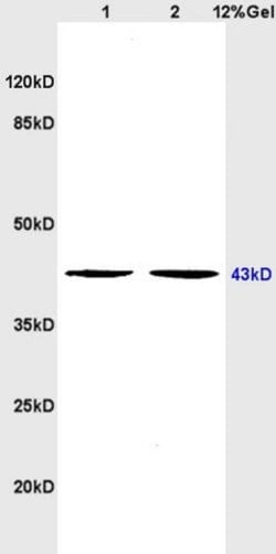 5HT4 Receptor Rabbit anti-Human, Polyclonal, Bioss 100 &mu;L; Unconjugated:Antibodies,