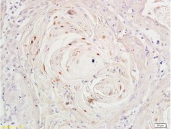 Ki-67 proliferation Marker Rabbit anti-Human, Polyclonal, Bioss 100 &mu;L;