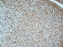 Ki-67 proliferation Marker Rabbit anti-Human, Polyclonal, Bioss 100 &mu;L;