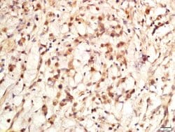 Ki-67 proliferation Marker Rabbit anti-Human, Polyclonal, Bioss 100 &mu;L;