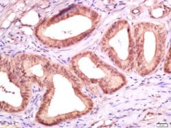 Ki-67 proliferation Marker Rabbit anti-Human, Polyclonal, Bioss 100 &mu;L;