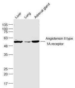 Angiotensin 2 type 1A receptor Rabbit anti-Human, Polyclonal, Bioss 100