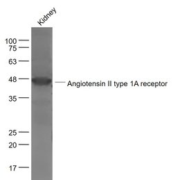 Angiotensin 2 type 1A receptor Rabbit anti-Human, Polyclonal, Bioss 100