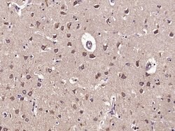 Phospho-GEF H1 (Ser886) Rabbit anti-Human, Polyclonal, Bioss 100 &mu;L;