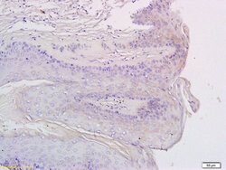CXCR3/CD183 Rabbit anti-Human, Polyclonal, Bioss 100 &mu;L; Unconjugated:Antibodies,