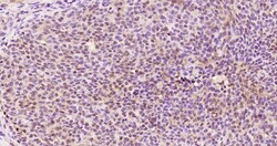 KRG2/DDX11 Polyclonal Antibody, Bioss 100 &mu;L; Unconjugated:Antibodies,