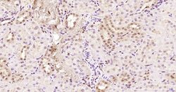 KRG2/DDX11 Polyclonal Antibody, Bioss 100 &mu;L; Unconjugated:Antibodies,
