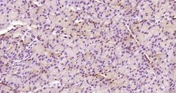 KRG2/DDX11 Polyclonal Antibody, Bioss 100 &mu;L; Unconjugated:Antibodies,