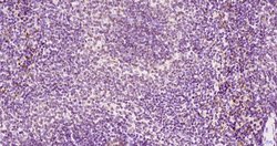 KRG2/DDX11 Polyclonal Antibody, Bioss 100 &mu;L; Unconjugated:Antibodies,