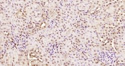 KRG2/DDX11 Polyclonal Antibody, Bioss 100 &mu;L; Unconjugated:Antibodies,