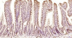 KRG2/DDX11 Polyclonal Antibody, Bioss 100 &mu;L; Unconjugated:Antibodies,