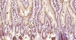 KRG2/DDX11 Polyclonal Antibody, Bioss 100 &mu;L; Unconjugated:Antibodies,