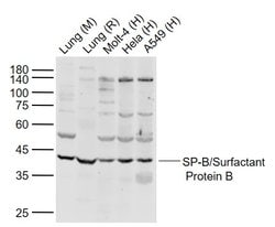 SP-B/Surfactant Protein B Polyclonal Antibody, Bioss 100 &mu;L; Unconjugated:Antibodies,