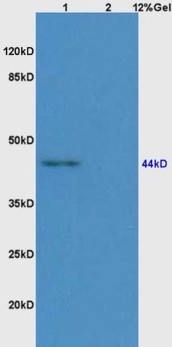 CD209 Rabbit anti-Human, Polyclonal, Bioss 100 μL; Unconjugated:Antibodies,