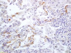 Integrin alpha V/CD51 Rabbit anti-Human, Polyclonal, Bioss 100 &mu;L; Unconjugated:Antibodies,
