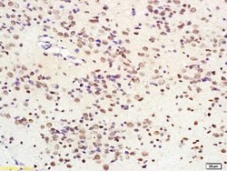 SIRT1/sirtuin 1 Rabbit anti-Human, Polyclonal, Bioss 100 &mu;L; Unconjugated:Antibodies,