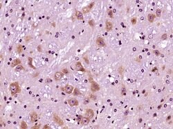 SIRT1/sirtuin 1 Rabbit anti-Human, Polyclonal, Bioss 100 &mu;L; Unconjugated:Antibodies,