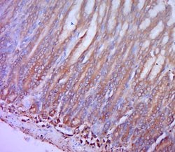 CCR2 Rabbit anti-Human, Polyclonal, Bioss 100 &mu;L; Unconjugated:Antibodies,