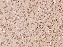 ATF6 Rabbit anti-Human, Polyclonal, Bioss 100 &mu;L; Unconjugated:Antibodies,