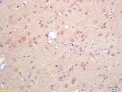 DGAT1/Diglyceride acyltransferase Rabbit anti-Human, Polyclonal, Bioss