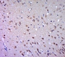 DGAT1/Diglyceride acyltransferase Rabbit anti-Human, Polyclonal, Bioss